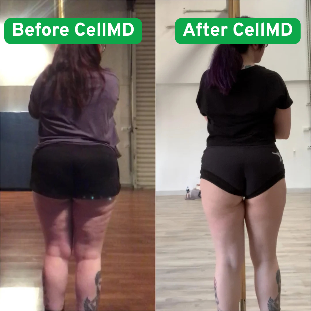 CellMD's Anti-Cellulite Massager
