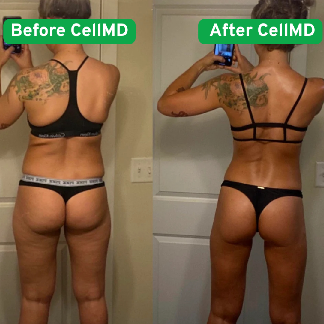 CellMD's Anti-Cellulite Massager