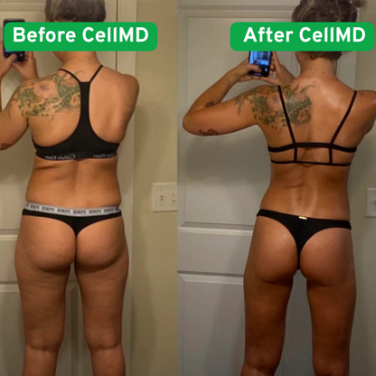CellMD's Anti-Cellulite Massager
